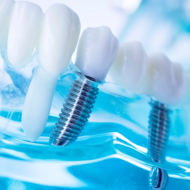 Home Olbia Arzachena Studio Dentistico Addis Impiantologia-Dentale