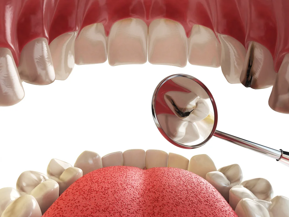 Odontoiatria Conservativa Olbia Arzachena Studio Dentistico Addis Odontoiatria Conservativa Studio-Dentistico Addis