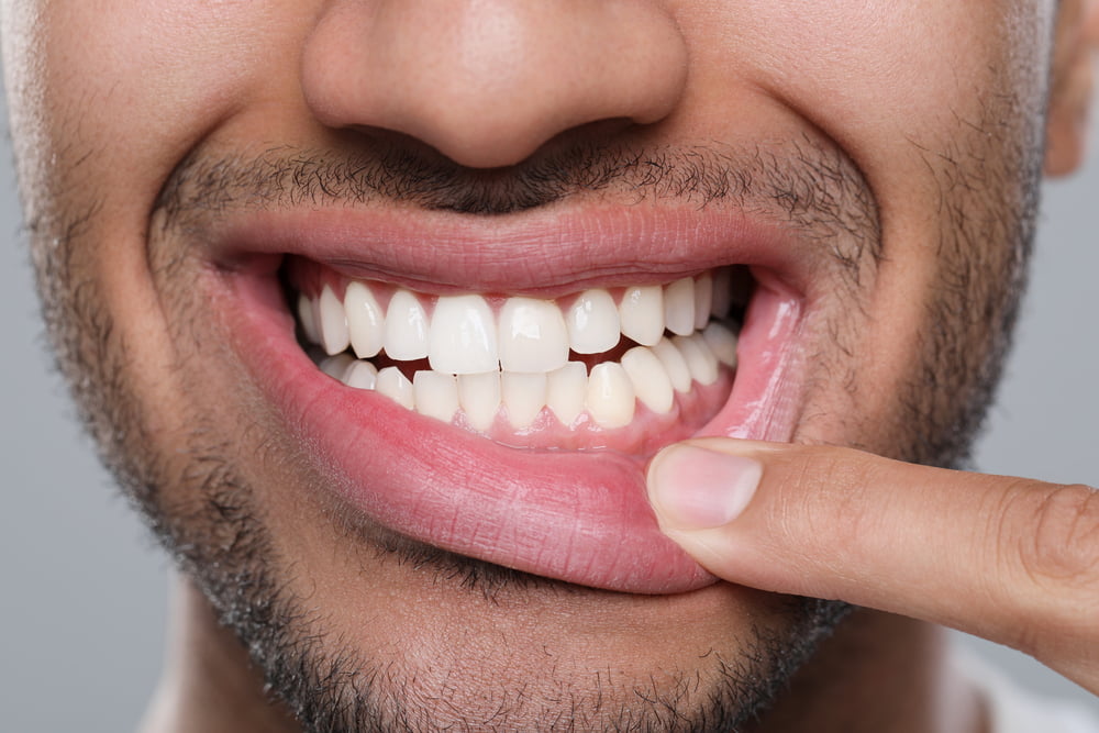 Parodontologia Olbia Arzachena Studio Dentistico Addis Parodontologia Studio Dentistico Addis