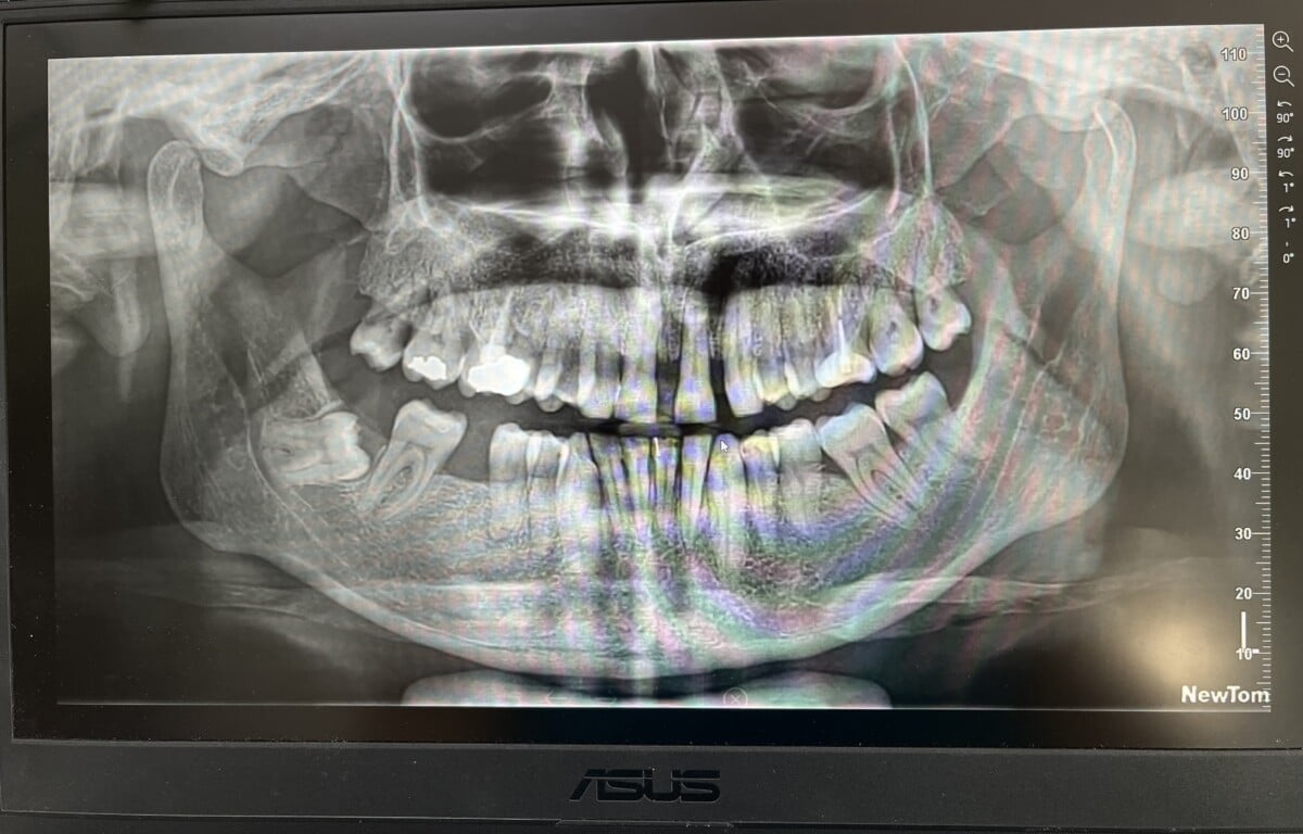 implantologia e chirurgia orale studio Addis Dentista Olbia Arzachena